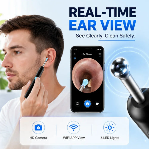Smart HD Ear Inspection Scope